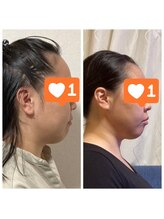 セブンドロップス(7drops)/フェイシャル