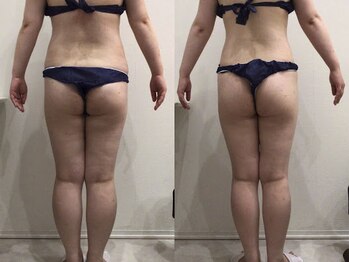 ビラ 銀座店(BILA)/キャビラジ