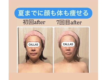 カラーズ(callas)の写真