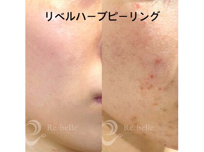 マヴィー(MAVIE)の写真