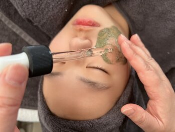 サロンラジュローズ(Salon La joue Rose)の写真/お肌のお悩みを解消したい方にオススメ☆敏感肌でも受けられる施術◎肌本来の美しさを引き出します。