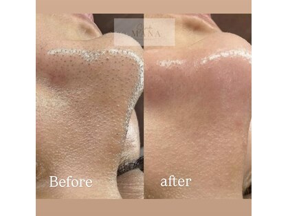 サロンドマナ(salon de MANA)の写真