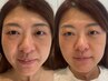 【超小顔に★】小顔ヘッドスパ