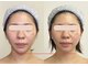 ソルニコン(Solnikon)の写真