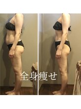 ムーン 高崎店(MOON)/痩身エステ