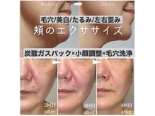 太陽と月の雰囲気（肌質改善×小顔×毛穴ケアを叶える深い癒し♪内側から整う美肌）