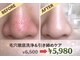ミントの写真