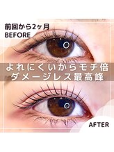 ハセミキ(Hase Miki)/アップフォースリフト（まつパ）