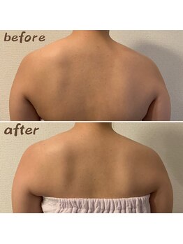 ルアナ 北谷店/リンパマッサージ 《沖縄/北谷》