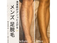 リズベット(LIZ BET)/【NEW】メンズ一部位脱毛体験！