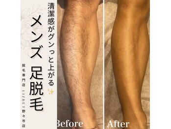 リズベット(LIZ BET)/【NEW】メンズ一部位脱毛体験！