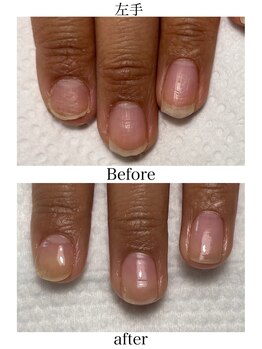 トイロ ネイル(Toiro Nail)/◇HAND◇クイックケア