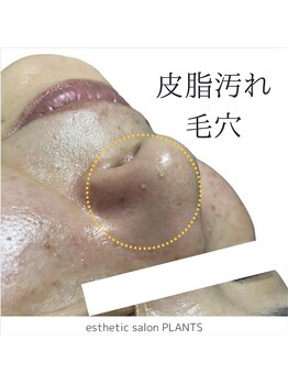 プランツ(PLANTS)/50代／１回／毛穴ケア
