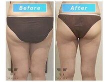 エムプラス(Mplus.)/スリムフェイスカッター♪