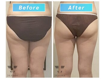 エムプラス(Mplus.)/スリムフェイスカッター♪