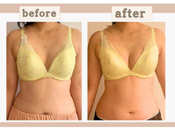 アンド ワイ(&y)/30代女性/出産歴なし