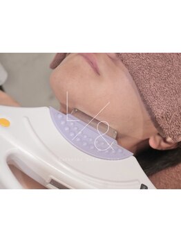 顔脱毛がしたい