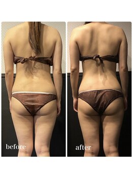 ピーラトゥ 日立(P-Ratu)/ブライダルコース