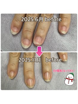 リエル(Liel)/爪が縦長に★ハンドネイルケア