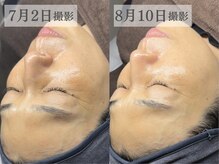 ダリア(Dahlia)/【水光肌はララピールで作る】