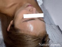 ナチュールムーン(Nature moon.)/ハーブピーリング　after