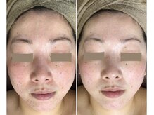 クレビア(CREBIA)/