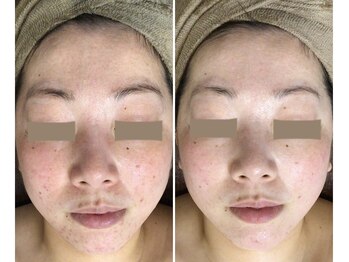 クレビア(CREBIA)/