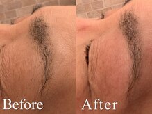 オハナ(Ohana)/眉毛脱毛/メンズ・レディースOK