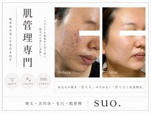 スオ(SUO.)の雰囲気(くすみ毛穴ニキビをケアし理想の素肌へ導く肌管理メニューです♪)