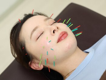 トータルトリートメント優鍼灸院の写真/【全身整体×美容鍼の相乗効果◎】全身整体で歪みを解き、美容鍼で巡りを整え、健康も美も根本改善◎