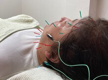 ばば鍼灸院/50代女性の方