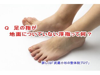 小池整体院/浮指って何？