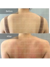 トニック バイ まつもと整骨院鍼灸院(Tonic)/★Before After★豊中／庄内