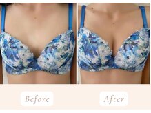 ノルン(Norn)の雰囲気(痩せ型さんもA→Cへサイズアップで谷間が作れる♪)