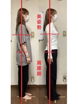 たか施術院/セルフケレッスン日常が練習場所