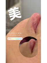 アート 熊本並木坂店(ART)/CSP/美白プラズマワックス/90分