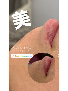 アート 熊本並木坂店(ART)/CSP/美白プラズマワックス/90分