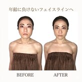 小顔整体研究所 KSラボ 藤が丘店