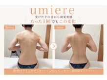 リュミエール(umiere)