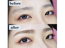 アイフラッシュ 阪急西宮ガーデンズ店(Eye Flash)/ビフォーアフター