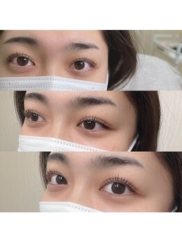 シェヌ(Chez nous)/＊ダメージレスラッシュリフト