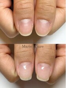 マリーロール 梅田店(Marie Laure)/自爪育成/深爪矯正/ネイルケア