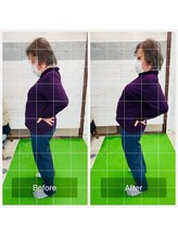 門前仲町イエティ鍼灸整骨院（旧：イエティ鍼灸整骨院）/ビフォーアフター♪