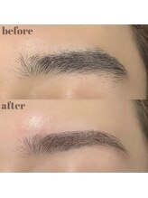 キンキー 広島(kinky)/