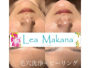 レアマカナ(LeaMakana)/毛穴洗浄+ピーリング