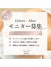【モニター募集☆】歪み小顔矯正+選べる矯正 ¥19,800 (通常¥82,500)