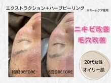 ミラ(Mira...)/☆Before→After☆