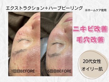 ミラ(Mira...)/☆Before→After☆