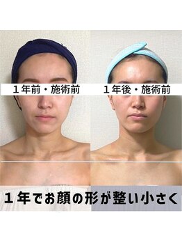 お顔の研究所/ビフォーアフター写真♪
