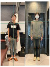 高崎カラダサポート鍼灸接骨院/骨盤矯正、姿勢改善